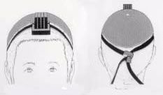 Placement of head-tefillin: Front and back view.