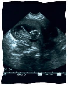 Detect gender when can ultrasound Can you